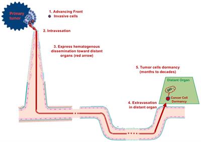 Hematogenous metastasis and tumor dormancy as concepts or dogma? The continuum of vessel co-option and angiotropic extravascular migratory metastasis as an alternative